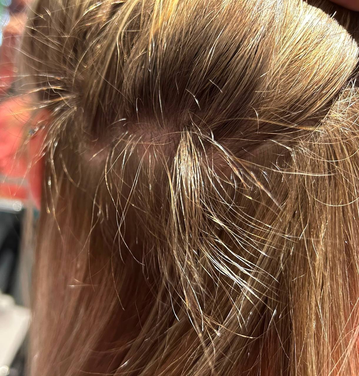 Haarkonzept &ndash; nachgewachsenes Haar an der Kopfhaut